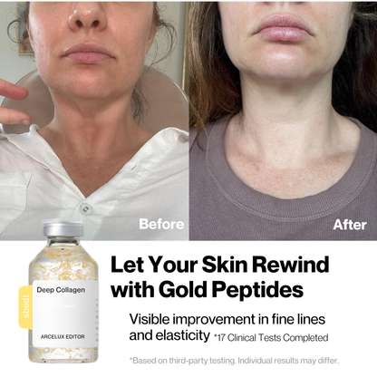 Arecelux Silk Lifting Peptide Ampoule