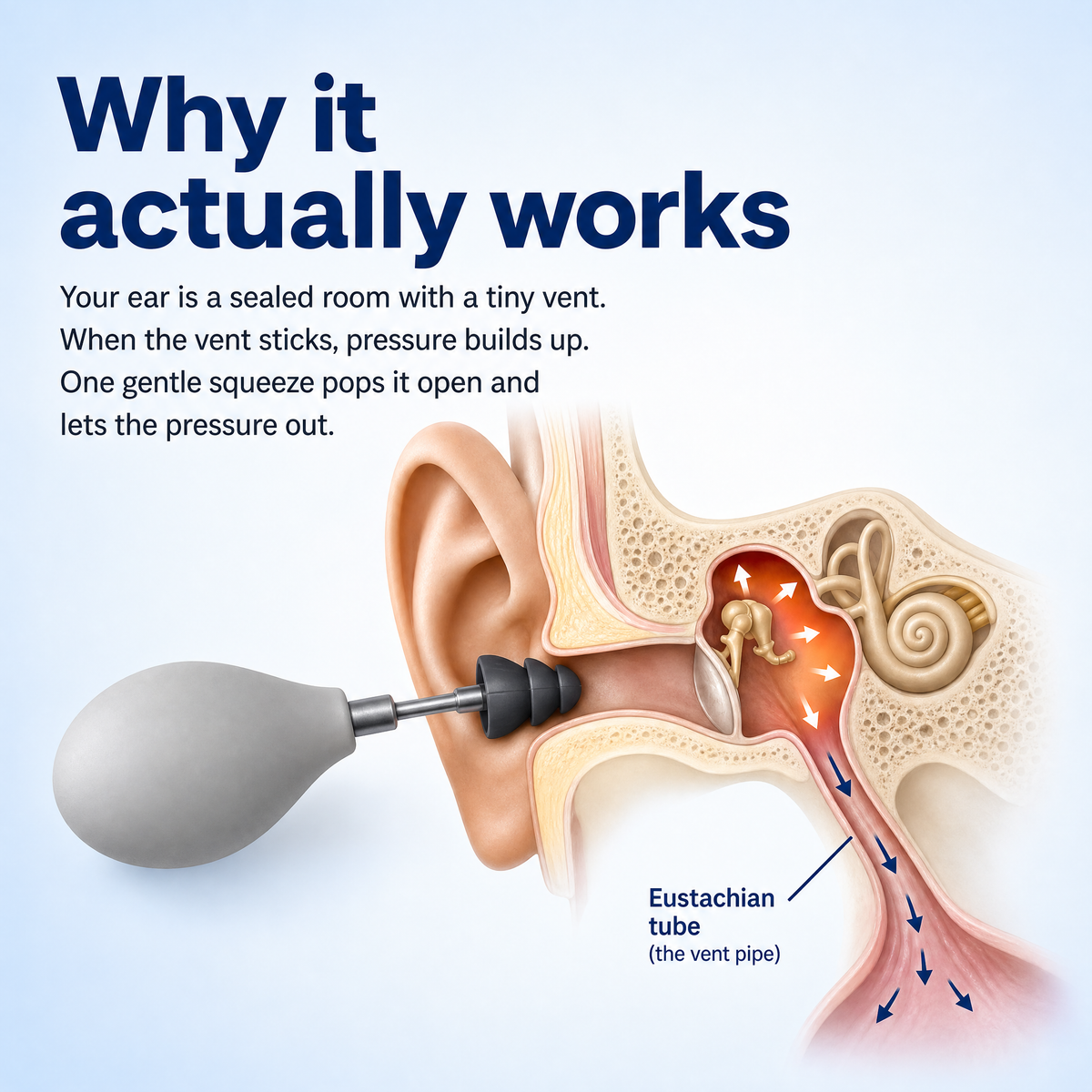 Arcelux Ear Fullness Release Tool