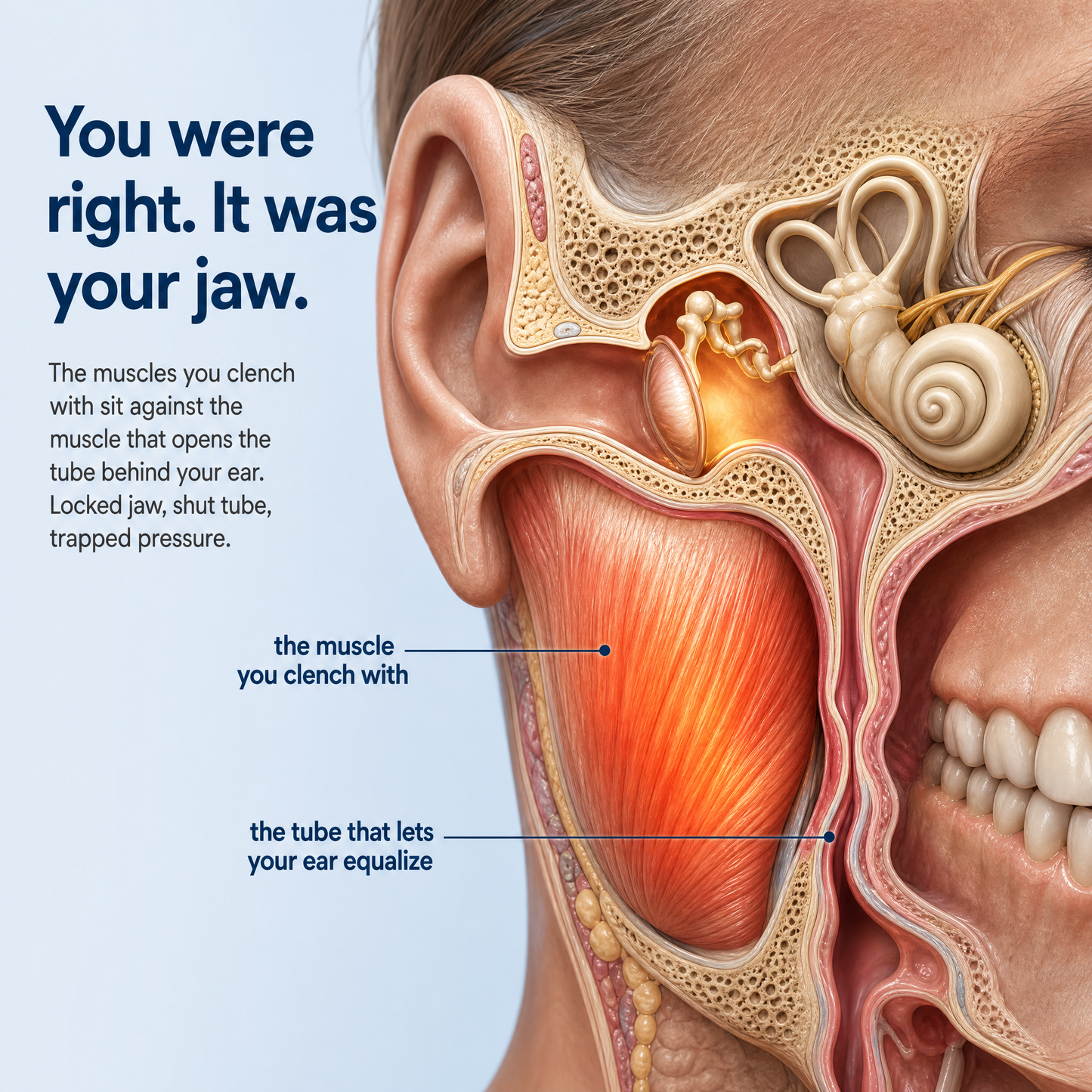 Arcelux Ear Fullness Release Tool